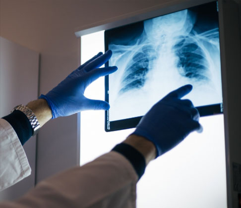 A provider reading an x-ray.