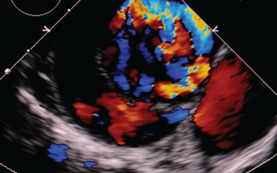 St. Joseph’s School of Cardiac Sonography Earns Prestigious Accreditation